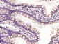 VDAC1 Recombinant Rabbit mAb, Mitochondrial Loading Control